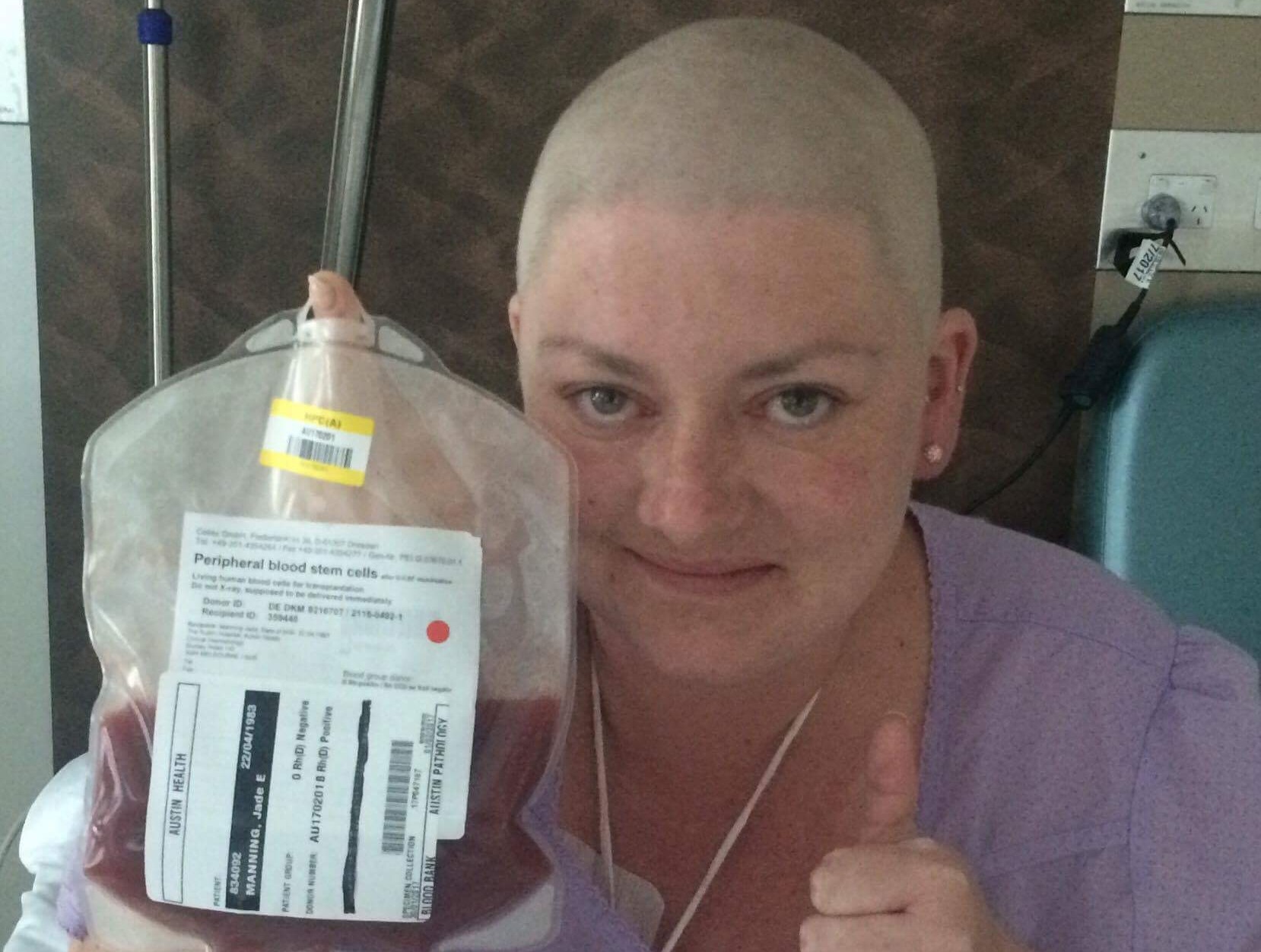 Stem Cell transplant Jan 2017