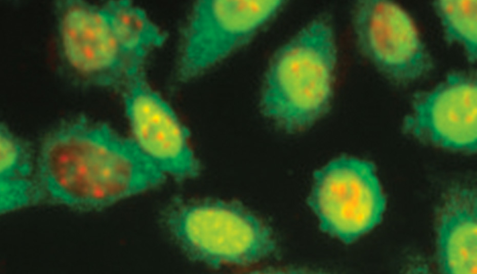 CancerResearch_RobinA