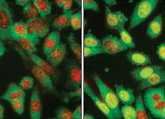 CancerResearch_RobinA_Small CancerResearch_RobinA_Small